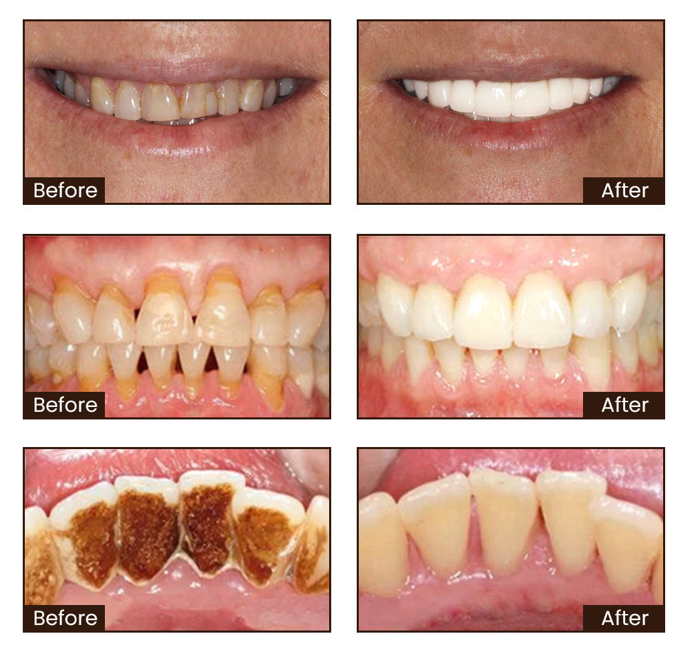 🦷 Say Goodbye to Stains & Bad Breath – Try LOVILDS™ Whitening Toothpaste!