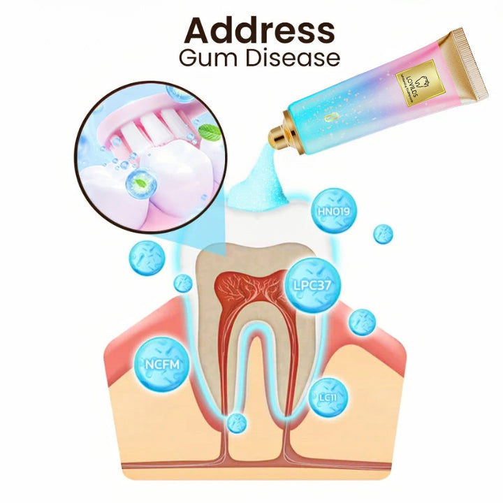 🦷 Say Goodbye to Stains & Bad Breath – Try LOVILDS™ Whitening Toothpaste!