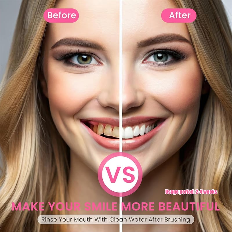 🦷 Say Goodbye to Stains & Bad Breath – Try LOVILDS™ Whitening Toothpaste!