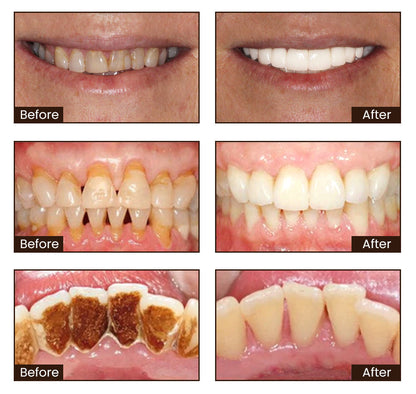 🦷 Say Goodbye to Stains & Bad Breath – Try LOVILDS™ Whitening Toothpaste!
